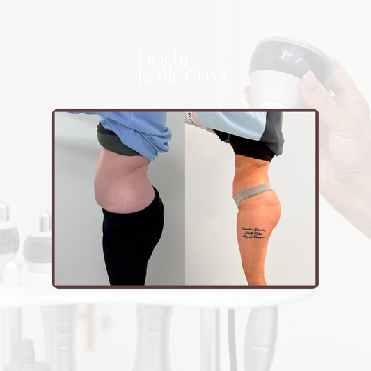 Advanced Body Sculpting Model Packages