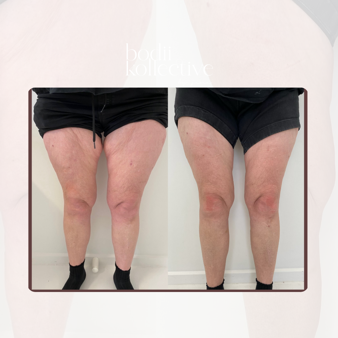 BODY SCULPTING PACKAGES