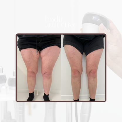 Advanced Body Sculpting Model Packages