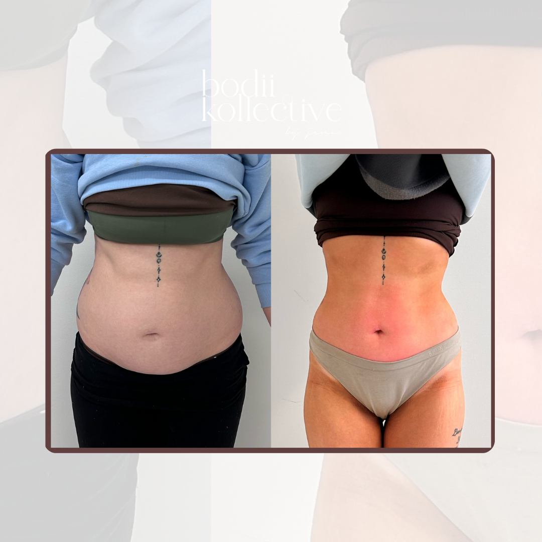 BODY SCULPTING PACKAGES