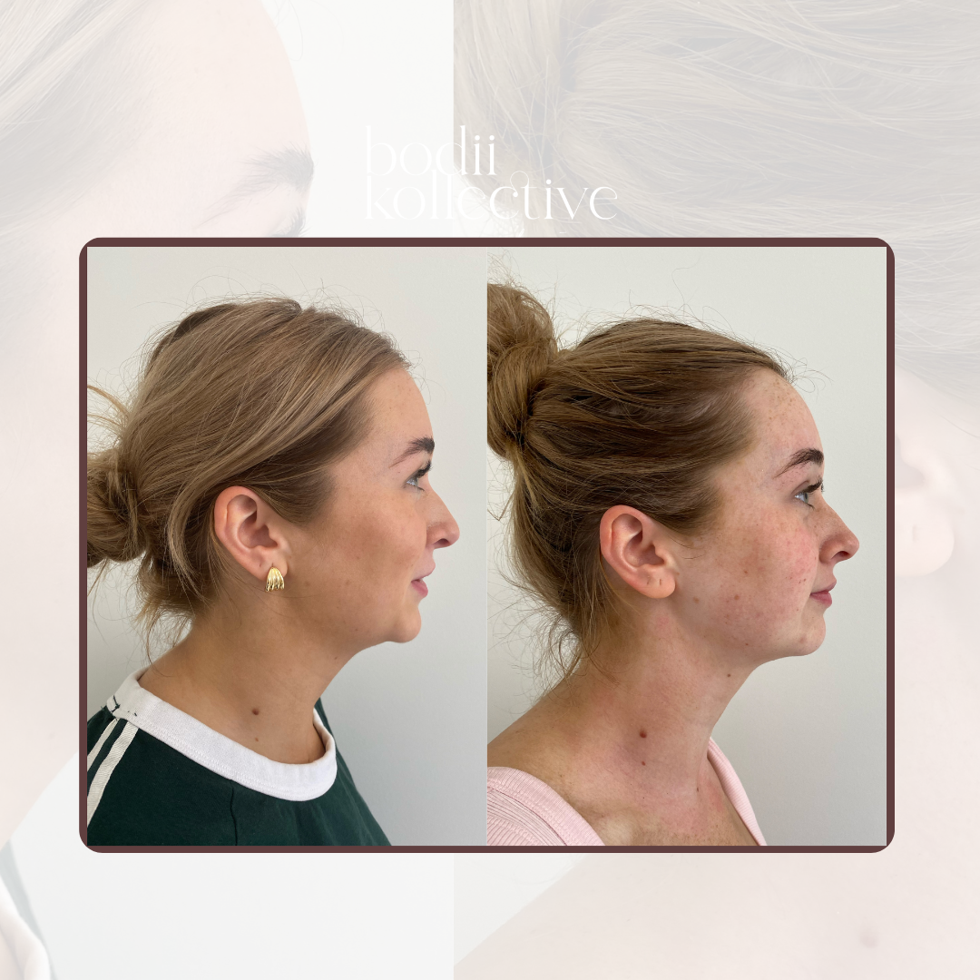 BODY SCULPTING PACKAGES